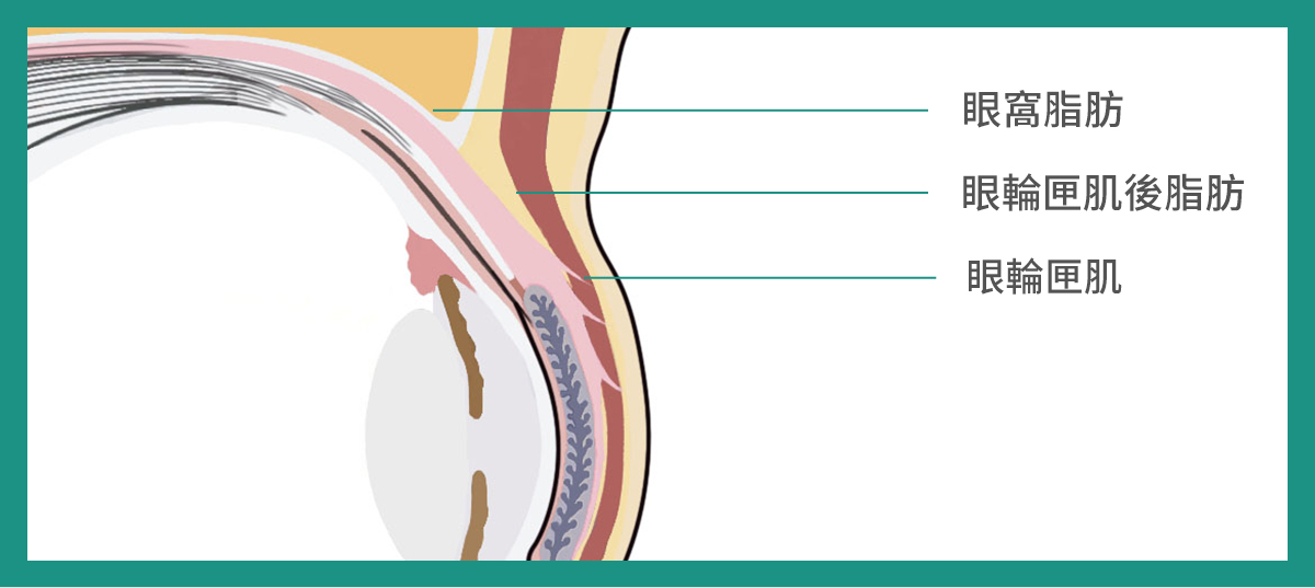 雙眼皮手術選擇02