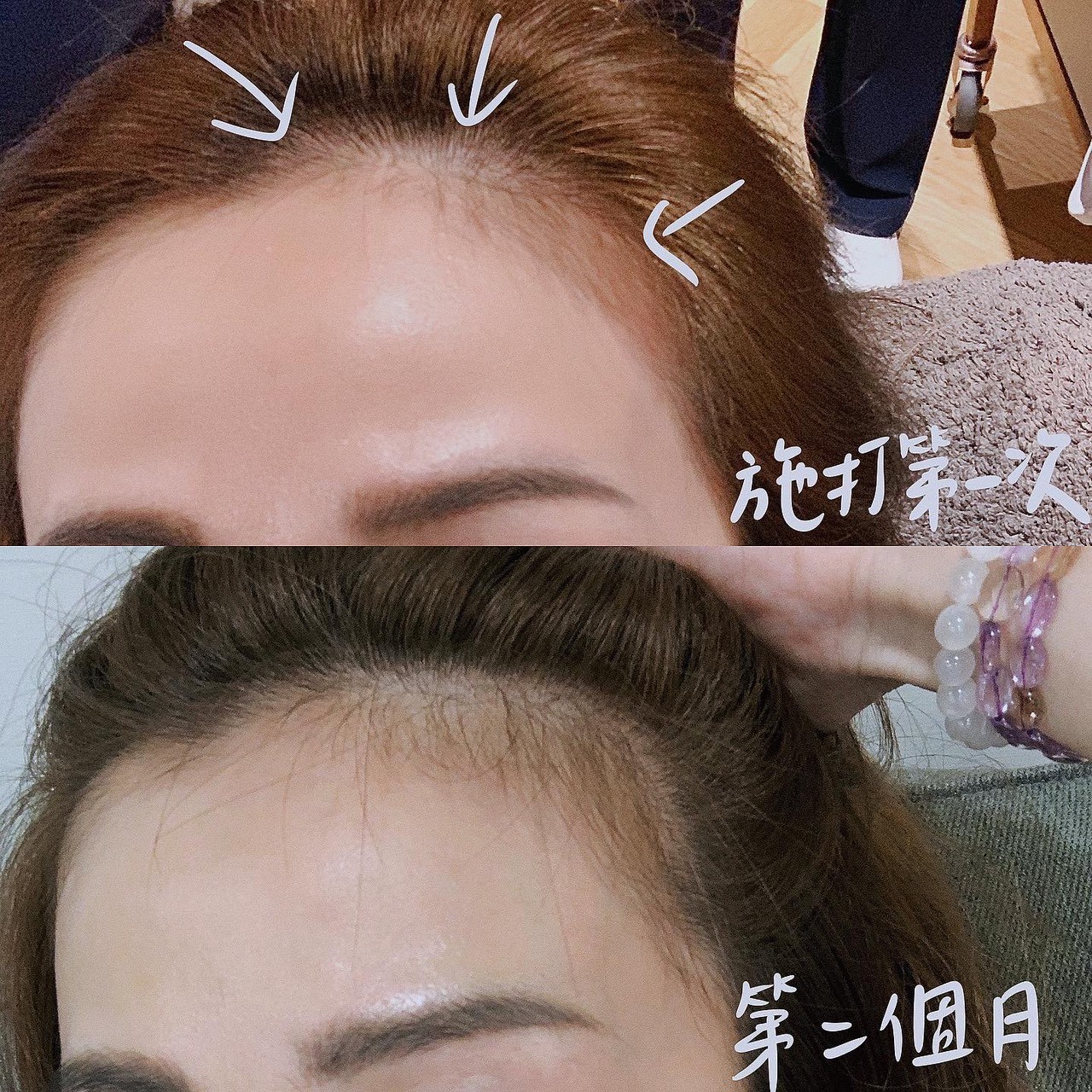 生发4