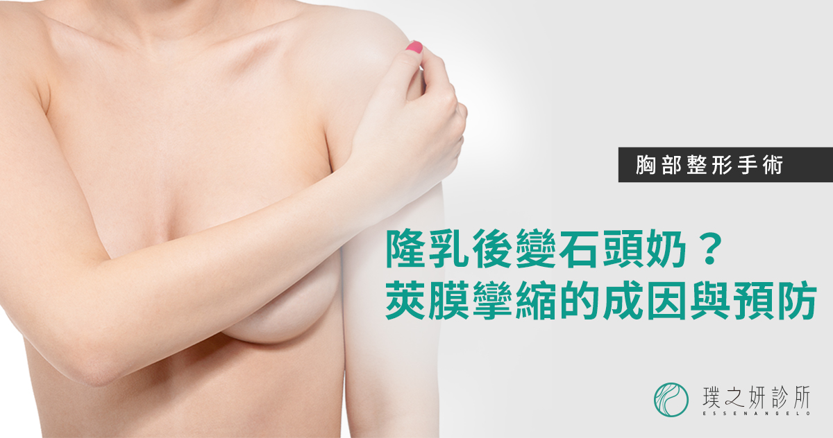轉貼顯示圖_魔滴隆乳