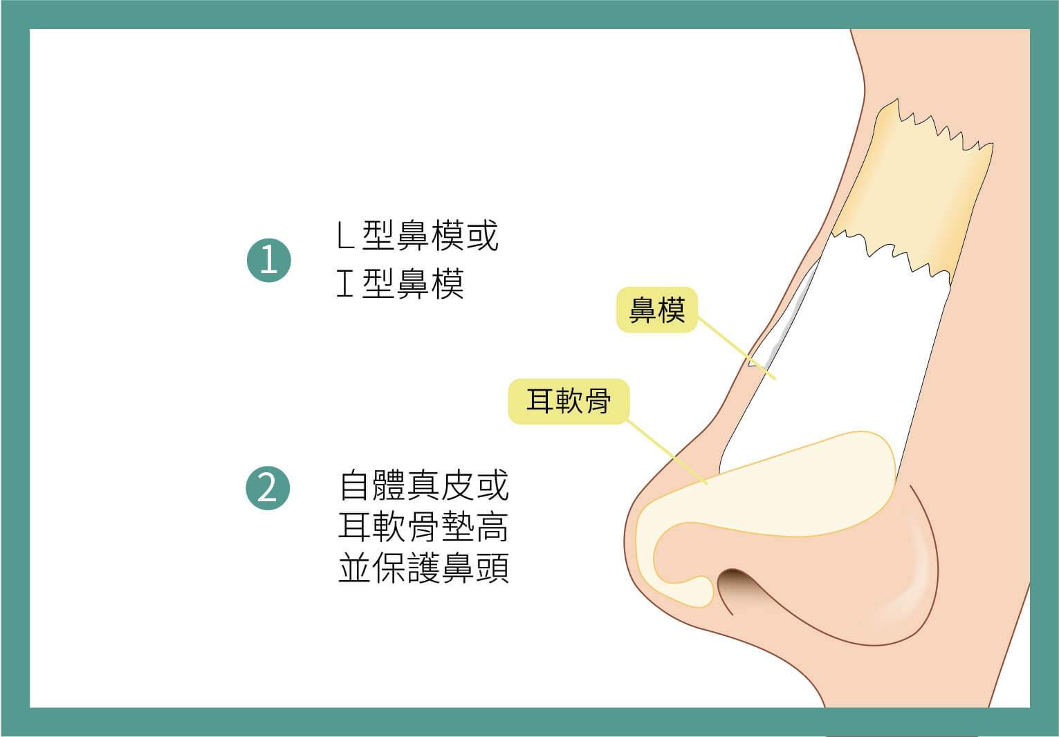 結構式隆鼻手術 - 台大皮膚專科領軍|璞之妍診所