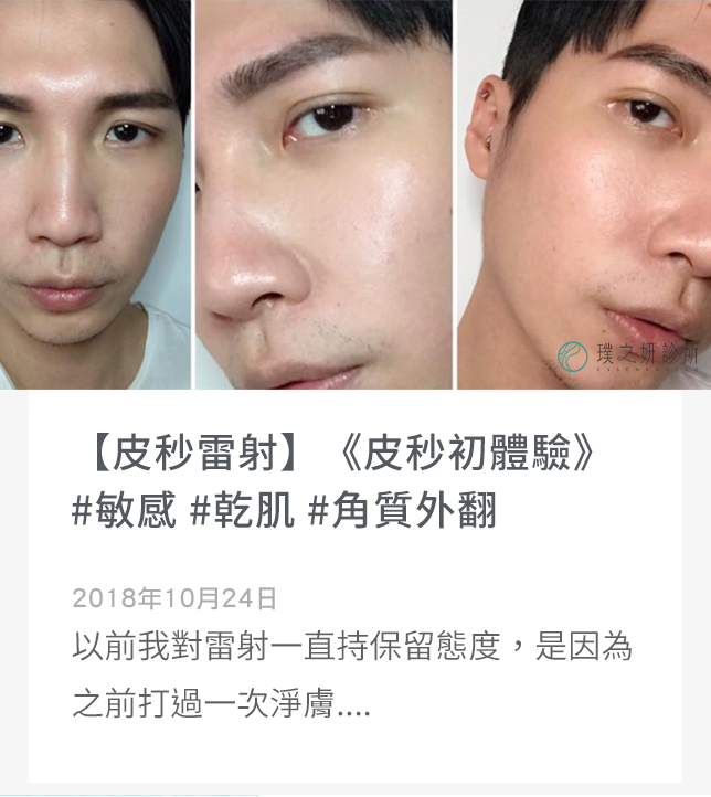 https://www.essenangelo.com/%e3%80%90%e7%9a%ae%e7%a7%92%e9%9b%b7%e5%b0%84%e3%80%91%e3%80%8a%e7%9a%ae%e7%a7%92%e5%88%9d%e9%ab%94%e9%a9%97%e3%80%8b%e6%95%8f%e6%84%9f-%e4%b9%be%e8%82%8c-%e8%a7%92%e8%b3%aa%e5%a4%96%e7%bf%bb/
